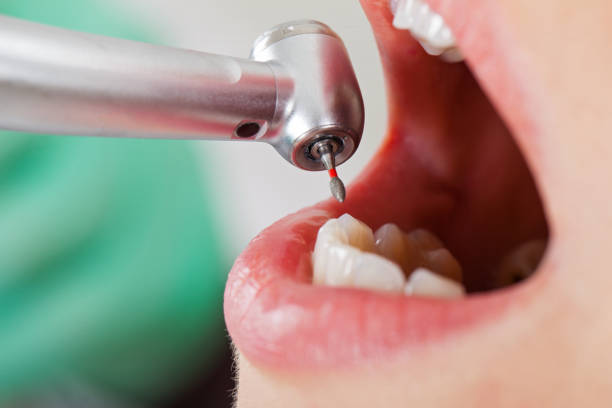 Best Tooth Pain Emergency Relief  in Flandreau, SD